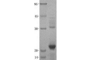 Validation with Western Blot (CXCL9 Protein (His tag))