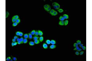 Immunofluorescent analysis of PC-3 cells using ABIN7166973 at dilution of 1:100 and Alexa Fluor 488-congugated AffiniPure Goat Anti-Rabbit IgG(H+L) (CHM antibody  (AA 1-653))