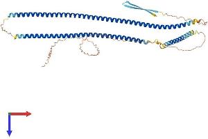 KRT12 Protein (AA 1-494) (His tag)