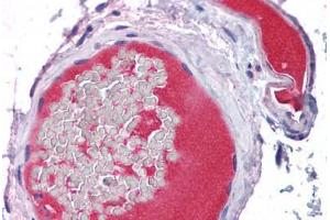 Vessels, Human: Formalin-Fixed, Paraffin-Embedded (FFPE) (PROC antibody)