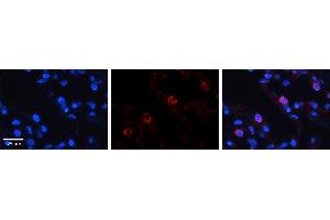 VARS antibody - middle region          Formalin Fixed Paraffin Embedded Tissue:  Human Lung Tissue    Observed Staining:  Cytoplasm of pneumocytes   Primary Antibody Concentration:  1:100    Other Working Concentrations:  1/600    Secondary Antibody:  Donkey anti-Rabbit-Cy3    Secondary Antibody Concentration:  1:200    Magnification:  20X    Exposure Time:  0. (VARS antibody  (Middle Region))