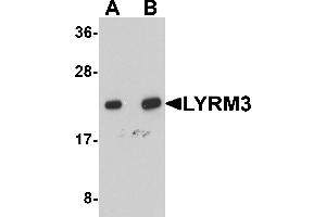 Western Blotting (WB) image for anti-NADH Dehydrogenase (Ubiquinone) 1 beta Subcomplex, 9, 22kDa (NDUFB9) (C-Term) antibody (ABIN1030500)