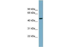Human Spleen; WB Suggested Anti-ATG4A Antibody Titration: 0. (ATG4A antibody  (Middle Region))