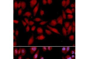 Immunofluorescence analysis of U2OS cells using PSMA2 Polyclonal Antibody