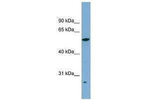 ALDH3A2 antibody used at 1 ug/ml to detect target protein.