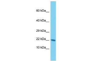 Host: Rabbit Target Name: NUDT3 Sample Type: Hela Whole Cell lysates Antibody Dilution: 1. (NUDT3 antibody  (Middle Region))