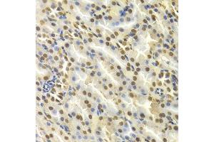 Immunohistochemistry (IHC) image for anti-Deoxycytidine Kinase (DCK) (AA 1-260) antibody (ABIN3022558) (DCK antibody  (AA 1-260))