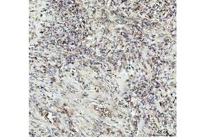 IHC analysis of G-CSF/CSF3 using anti-G-CSF/CSF3 antibody (ABIN3042762).