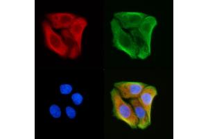 ABIN6258974 and ABIN6275995 staining Hela cells(30 min of UV treatment) by IF/ICC. (GPR137C antibody  (Internal Region))
