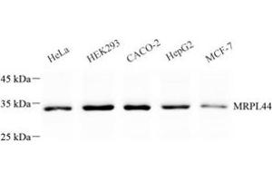 Western blot analysis of MRPL44 (ABIN7074647) at dilution of 1: 500 (MRPL44 antibody)