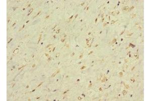 Immunohistochemistry of paraffin-embedded human smooth muscle tissue using ABIN7158484 at dilution of 1:100 (LONRF1 antibody  (AA 538-773))