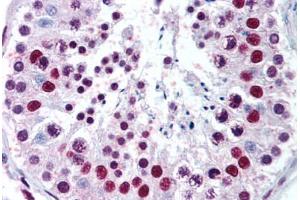 Testis (MECP2 antibody  (AA 11-25))