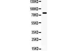 Anti- FE65 antibody, Western blotting All lanes: Anti  at 0. (FE65 antibody  (AA 295-613))