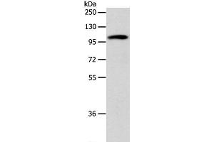 Western Blot analysis of 293T cell using ADCY1 Polyclonal Antibody at dilution of 1:1000 (ADCY1 antibody)