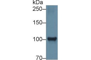 Detection of HK1 in Rat Cerebrum lysate using Polyclonal Antibody to Hexokinase 1 (HK1) (Hexokinase 1 antibody  (AA 413-540))