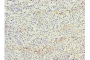 Immunohistochemistry of paraffin-embedded human spleen tissue using ABIN7171725 at dilution of 1:100 (ZBTB48 antibody  (AA 1-280))