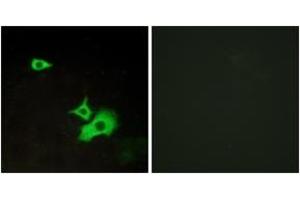 Immunofluorescence analysis of LOVO cells, using ETBR2 Antibody. (ETBR2 antibody  (AA 1-50))