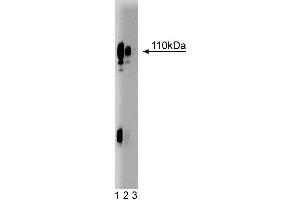 Western blot analysis of Lamp-1 on HepG2 cell lysate. (LAMP1 antibody  (AA 25-224))