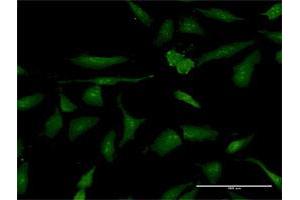 Immunofluorescence of purified MaxPab antibody to PSME3 on HeLa cell. (PSME3 antibody  (AA 1-254))