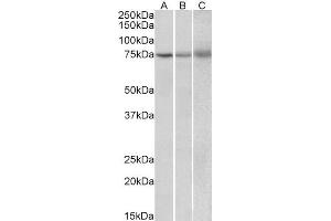 ABIN2563581 (2µg/ml) staining of Human (A), Mouse (B) and Rat (C) Spleen lysate (35µg protein in RIPA buffer). (KLHL6 antibody  (Internal Region))