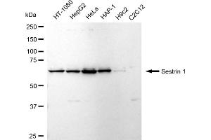 Western blotting analysis using Sestrin 1 antibody (ABIN7800321).