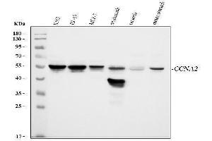 Western blot analysis of Cyclin A2 using anti-Cyclin A2 antibody (ABIN3043481). (Cyclin A antibody  (AA 10-168))