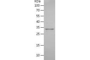 Western Blotting (WB) image for Uroplakin 2 (UPK2) (AA 85-184) protein (His-IF2DI Tag) (ABIN7282937) (Uroplakin 2 Protein (UPK2) (AA 85-184) (His-IF2DI Tag))