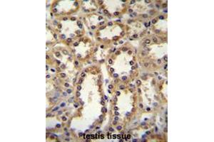 GPC6 Antibody (C-term) immunohistochemistry analysis in formalin fixed and paraffin embedded human kidney tissue followed by peroxidase conjugation of the secondary antibody and DAB staining.