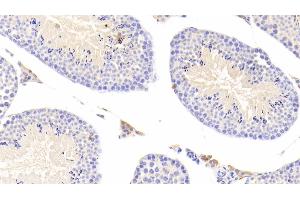 Detection of CTSS in Mouse Testis Tissue using Polyclonal Antibody to Cathepsin S (CTSS) (Cathepsin S antibody  (AA 123-339))