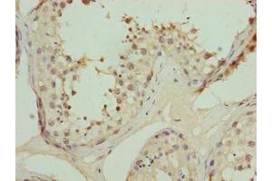 Immunohistochemistry of paraffin-embedded human testis tissue using ABIN7162475 at dilution of 1:100 (TRIP13 antibody  (AA 181-390))