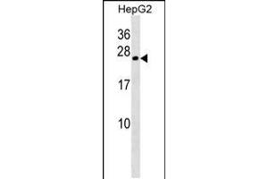 Western blot analysis in HepG2 cell line lysates (35ug/lane). (CRYGB antibody  (AA 68-97))