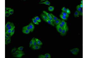 Immunofluorescence staining of HepG2 cells with ABIN7170156 at 1:100, counter-stained with DAPI. (SLC22A25 antibody  (AA 31-145))