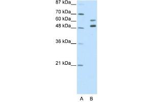 Western Blot showing ZNF682 antibody used at a concentration of 1-2 ug/ml to detect its target protein.