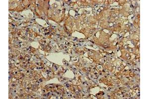 Immunohistochemistry of paraffin-embedded human adrenal gland tissue using ABIN7164181 at dilution of 1:100 (SLU7 antibody  (AA 138-310))
