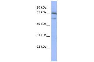 WB Suggested Anti-NFKBIE Antibody Titration:  0.