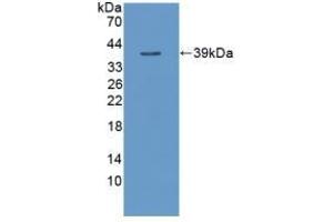 Detection of Recombinant TNFaIP3, Human using Polyclonal Antibody to Tumor Necrosis Factor Alpha Induced Protein 3 (TNFaIP3) (TNFAIP3 antibody  (AA 1-300))