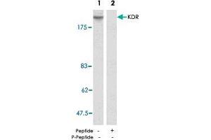 Western blot analysis of extract from SK-OV-3 cells using KDR polyclonal antibody  . (VEGFR2/CD309 antibody)