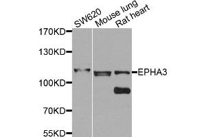 Western blot analysis of extracts of various cell lines, using EPHA3 antibody. (EPH Receptor A3 antibody)