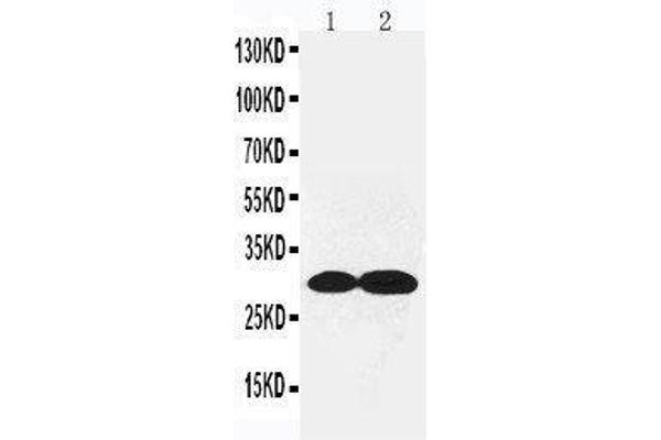 COL4a2 antibody  (C-Term)