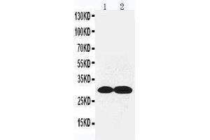 Anti-Collagen IV antibody, Western blotting Lane 1: Rat Kidney Tissue Lysate Lane 2: Rat Lung Tissue Lysate