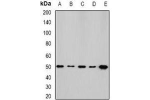 Western blot analysis of NFS1 expression in HepG2 (A), SKOV3 (B), mouse kidney (C), mouse heart (D), rat liver (E) whole cell lysates. (NFS1 antibody)