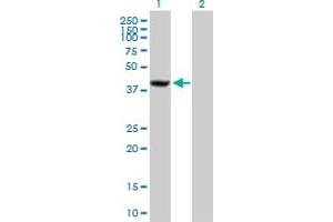 Western Blot analysis of SDCCAG8 expression in transfected 293T cell line by SDCCAG8 MaxPab polyclonal antibody. (SDCCAG8 antibody  (AA 1-360))