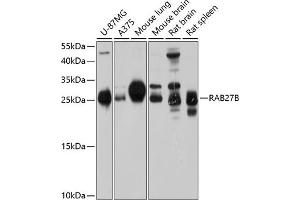 Western blot analysis of extracts of various cell lines, using RB antibody (ABIN6132610, ABIN6146565, ABIN6146566 and ABIN6214629) at 1:1000 dilution. (RAB27B antibody  (AA 1-218))