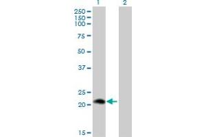 Western Blot analysis of PLA2G12A expression in transfected 293T cell line by PLA2G12A monoclonal antibody (M01), clone 1D11. (PLA2G12A antibody  (AA 90-188))