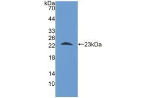 Western blot analysis of recombinant Human STIP1. (STIP1 antibody  (AA 1-169))
