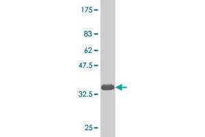 Western Blot detection against Immunogen (35. (NKX6-1 antibody  (AA 191-275))