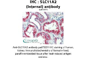Image no. 1 for anti-Solute Carrier Family 11 (Proton-Coupled Divalent Metal Ion Transporters), Member 2 (SLC11A2) (Internal Region) antibody (ABIN1739323) (SLC11A2 antibody  (Internal Region))