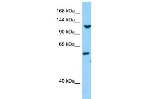 WB Suggested Anti-TLL1 Antibody Titration: 1.
