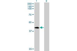 Western Blot analysis of CCNDBP1 expression in transfected 293T cell line by CCNDBP1 monoclonal antibody (M02), clone 3B7. (CCNDBP1 antibody  (AA 261-360))