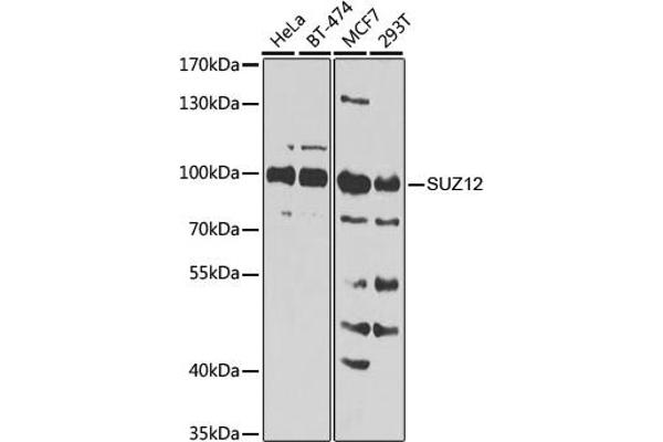 SUZ12 抗体  (AA 470-739)